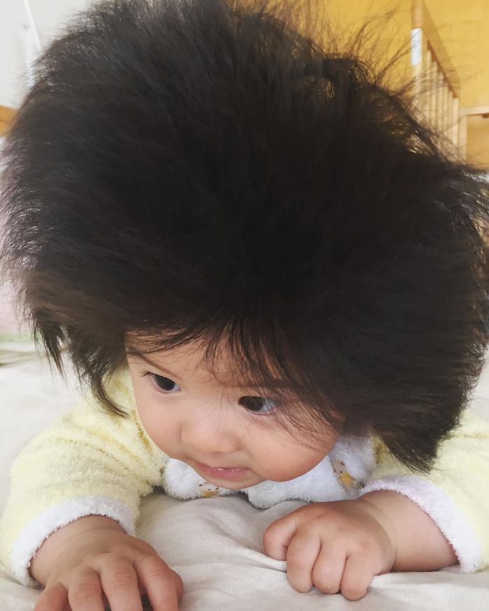 Baby Chanco, bayi dengan rambut terlebat